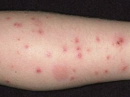 İşyeri İlaçlama Hizmetinin İşletmelere Sağladığı Avantajlar