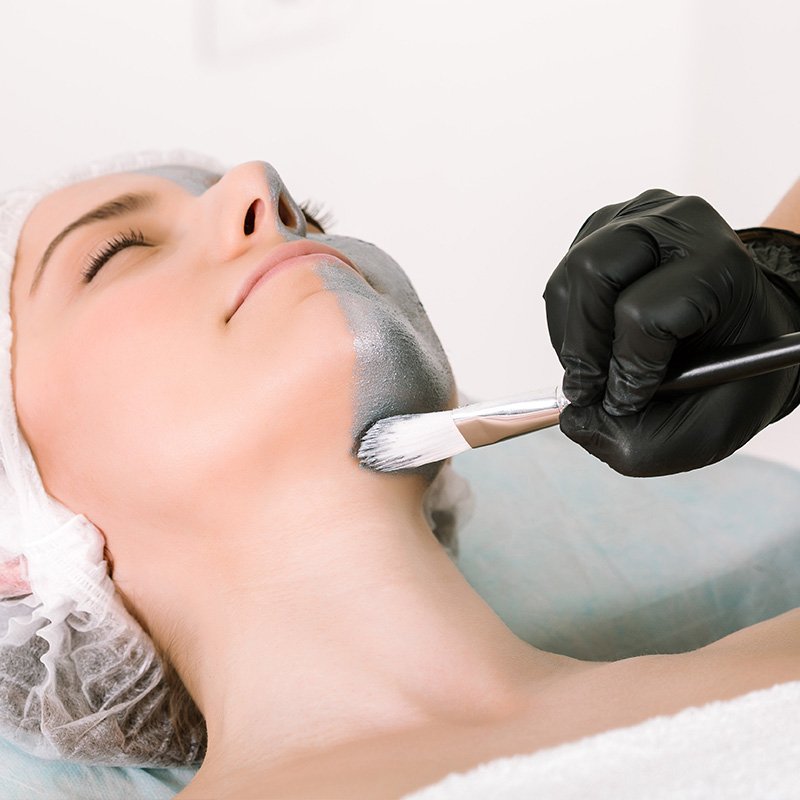 peeling-uygulamalari