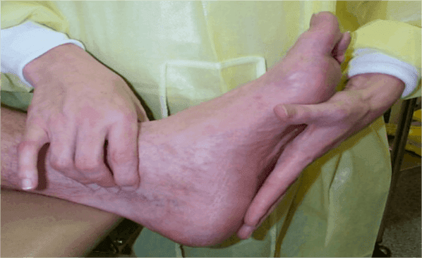 atardamar klinik/tanı