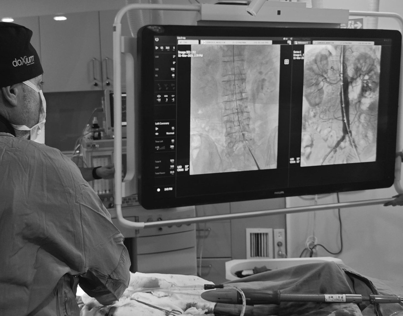 Aort-Anevrizmalarında-Tedavi