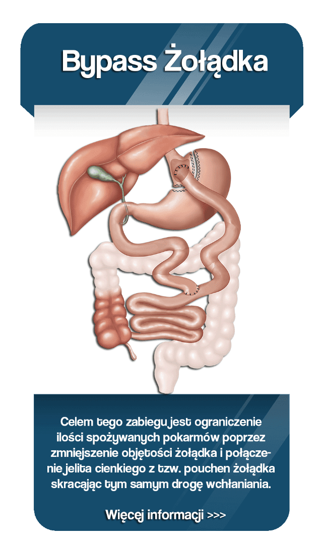 Web_Home_Pol_Gastric_Bypass