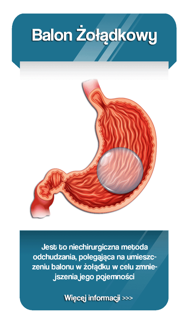 Web_Home_Pol_Gastric_Balloon