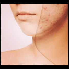 Uzm. Dr. Dermatolog Sevim Güler / Antalya