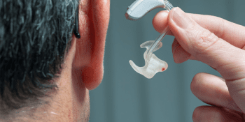 Kulak Kalıbında 3D Baskı Teknolojisi