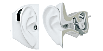 İşitme cihazı nedir?