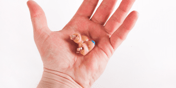 Eskişehir İşitme Cihazları ve Aksesuarları