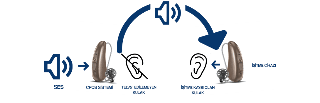 cros-cihazlar-nasil-calisir