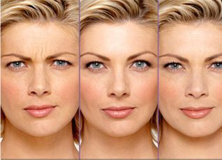 Botoks uygulamasının yan etkisi