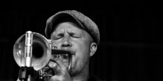 Saç Nakli Yaptıran Ünlüler