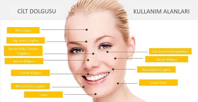 dolgu_nerelere_yapilir