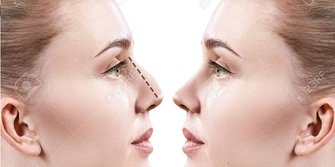 Estetik Burun Ameliyatı