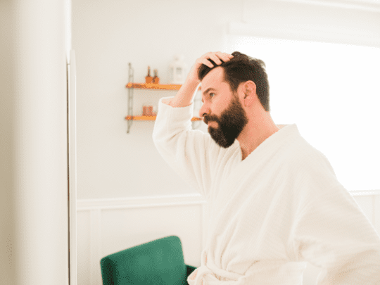 Top 5 Questions We Get About a Receding Hairline from Our Patients