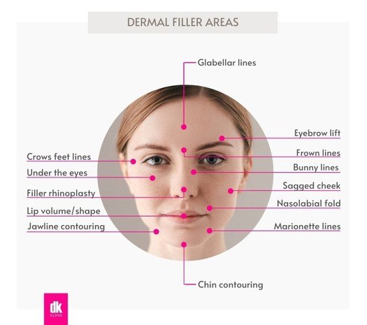 Dermal filler
