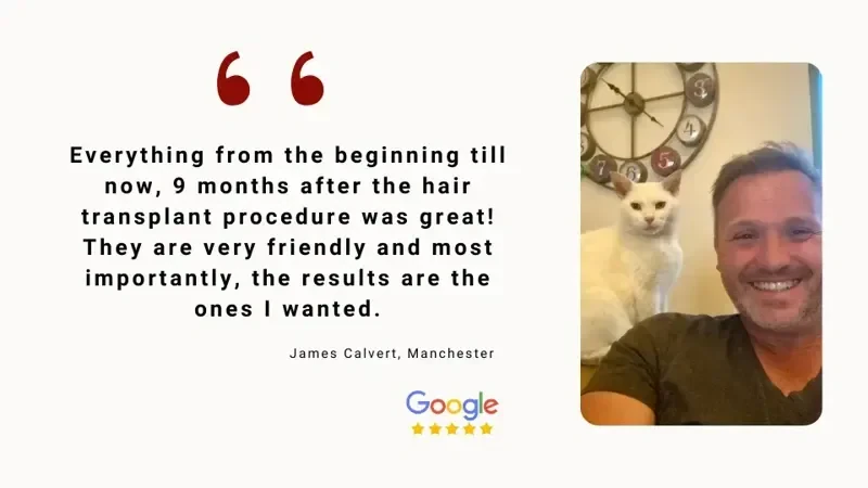 Hair-Transplant-Turkey-Before-After-Testimonial