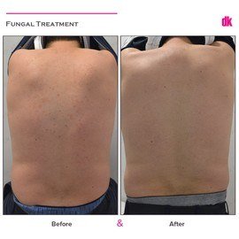 DERMATOLOGICAL ILLNESS TREATMENTS - Before and After