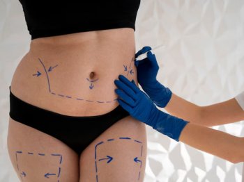 Ankara’da En Etkili Bölgesel Zayıflama Yöntemleriyle Hızlı Sonuç Alın!