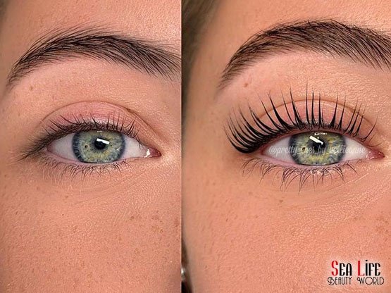 Ankara-Kirpik-Lifting-Oncesi-Sonrasi