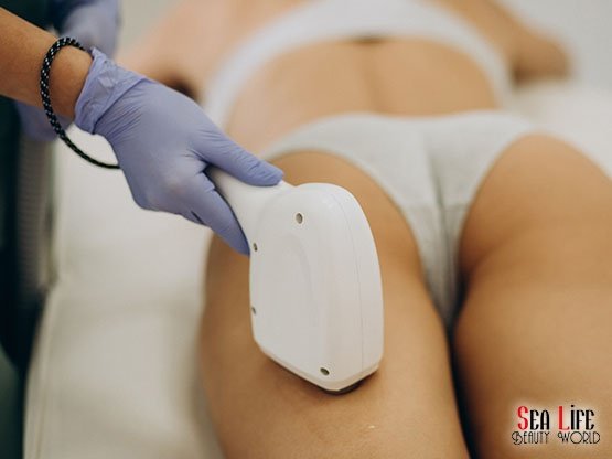 Kizilay-Lazer-Epilasyon-Fiyatlari-Ankara