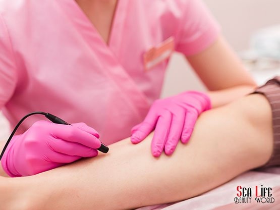 Igneli-Epilasyon-Konforlu-Ankara-Kizilay