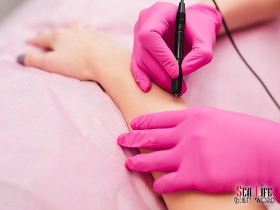 Ankara-Igneli-Epilasyon-Hizmetleri