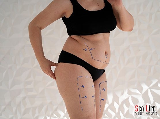 Ankara-Zayiflama-Incelme-Bahar-Donusum