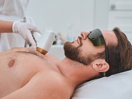 Ankara Erkek Lazer Epilasyon Kızılay Güzellik Merke