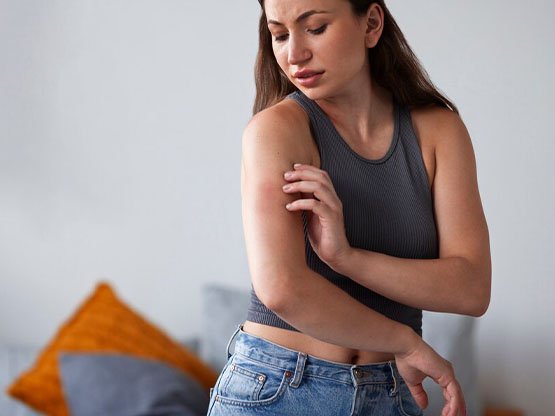 Ankara Lazer Epilasyon sonrası kızarıklık Güzelli