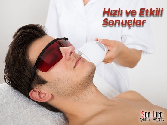 Ankara Erkek Lazer Epilasyon