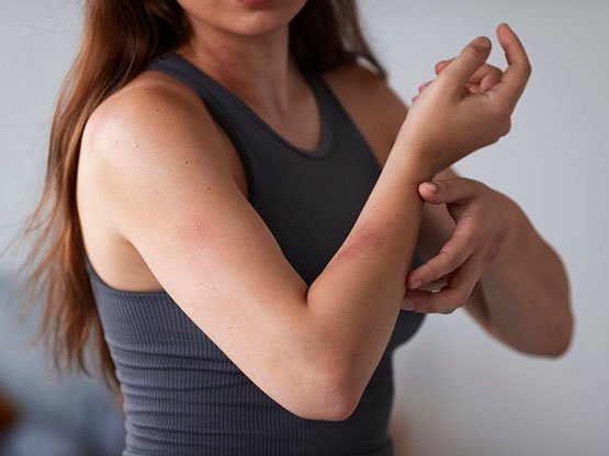 İğneli epilasyonun riskleri nelerdir Ankara'da iğne