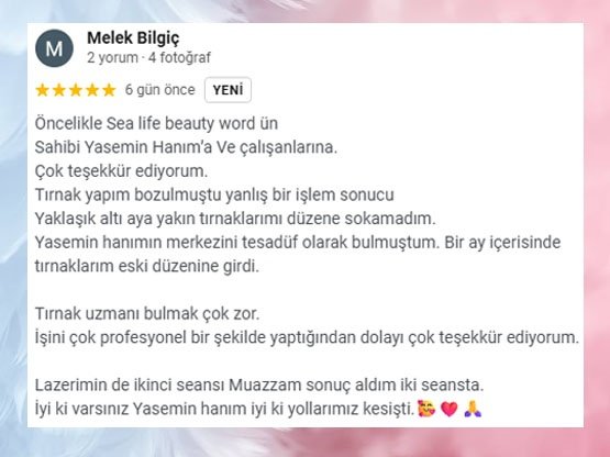 Kizilay-Lazer-Epilasyon-Tavsiyesi-Ve-Yorumu-Melek-Hanim