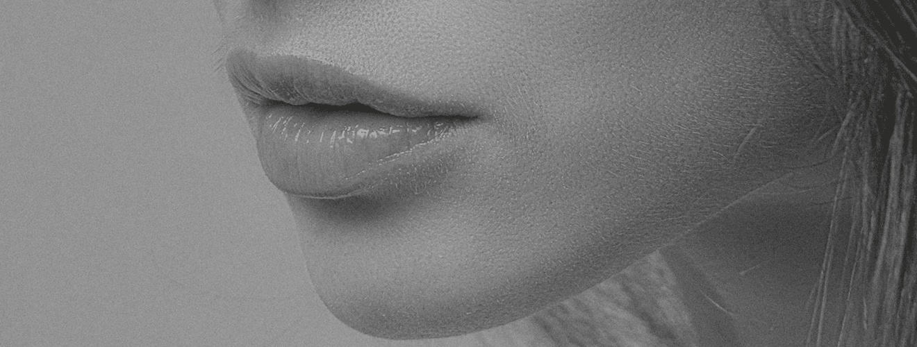 Ağız köşesi kaldırma (mouth corner lift) ameliyatı ile hedeflenen dudak kenarı ve çene bölgesi yakın çekimi.