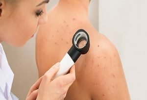 dermatoskopi-300x204