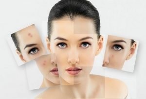 enzim-peeling-300x204