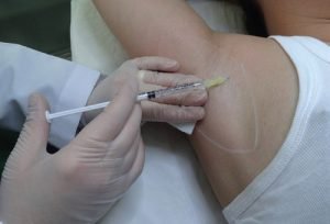 terleme-botoksu-2-300x204