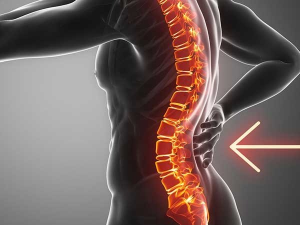 Lomber-Lordoz-Azalma-Nedir