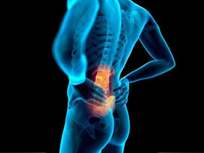 Lomber Lordoz Nedir? Neden Olur, Neler Yapılmalıdır?