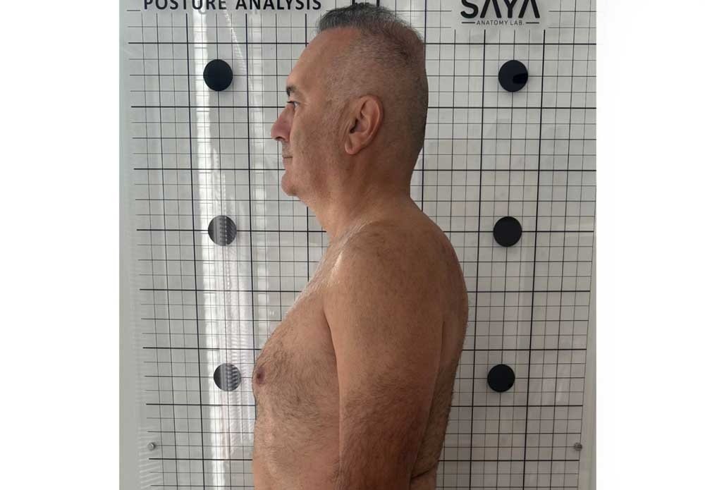 Kifozda-Duzeltici-Egzersiz-1