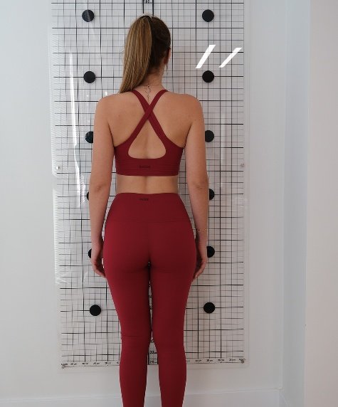 Posterior (arka) Açıdan