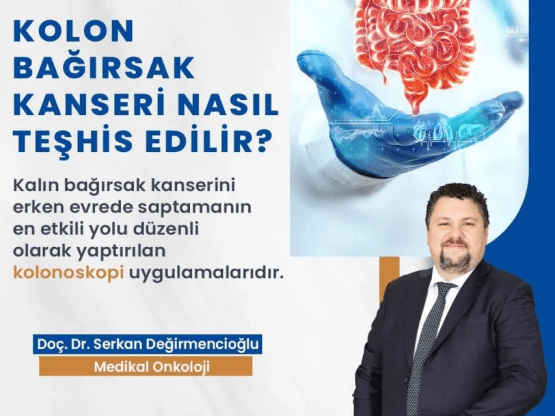 KOLON BAĞIRSAK KANSERİ NASIL TEŞHİS EDİLİR?