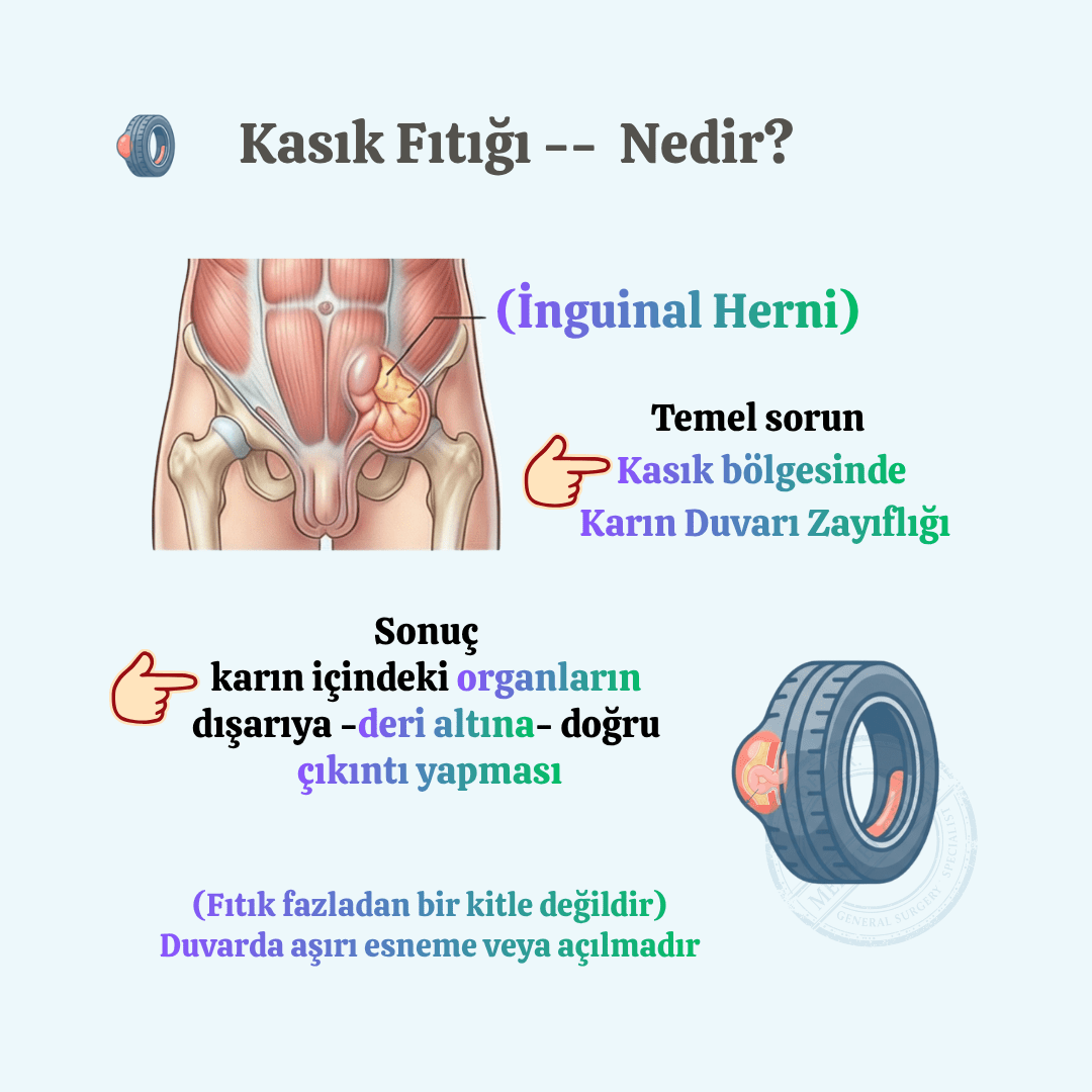 Kfn