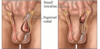 NEDEN ERKEKLERDE DAHA SIK GÖRÜLÜR?