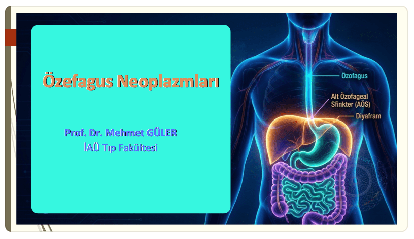 Özefagus Neoplazmlari