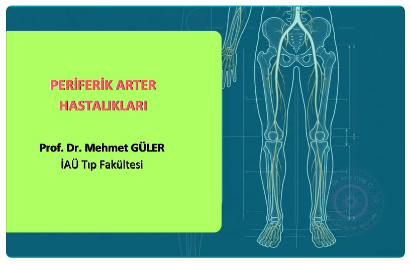 Periferik Arter Hastalıkları