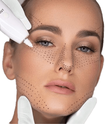 Plexr-Plazma-Tedavisi