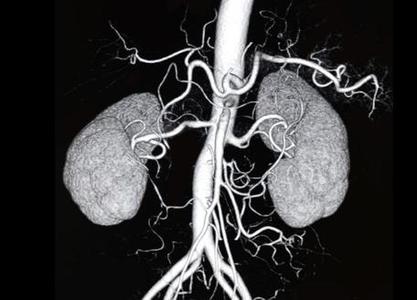 Bilgisayarlı Tomografi 3