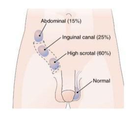 Testis Ultrasonografisi