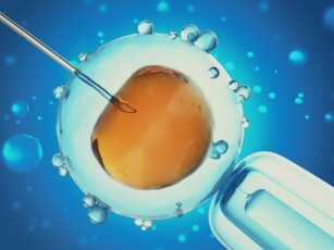 EGG DONATION IN CYPRUS