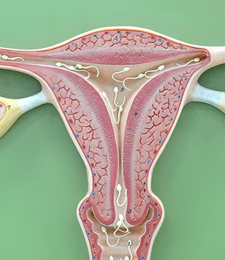 IUI (INTRAUTERIN INSEMINATION)