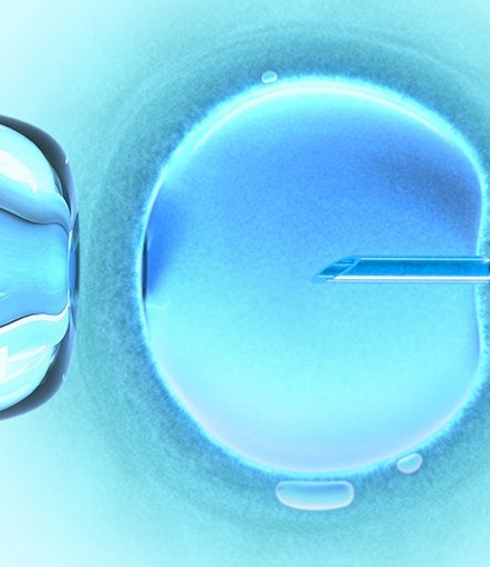 IVF ICSI