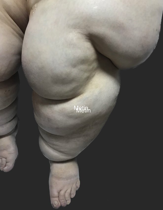 Mega